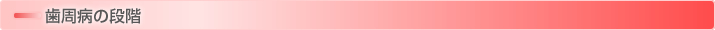 歯周病の段階　歯の根元に少し歯垢や歯石がついている。 あまり自覚症状はない。 
